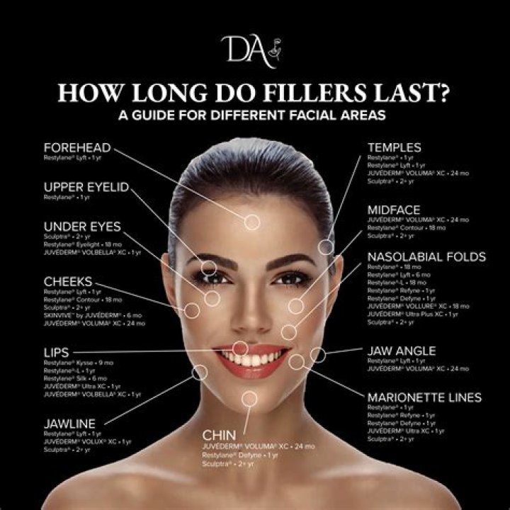 Can you put filler in 11 lines?